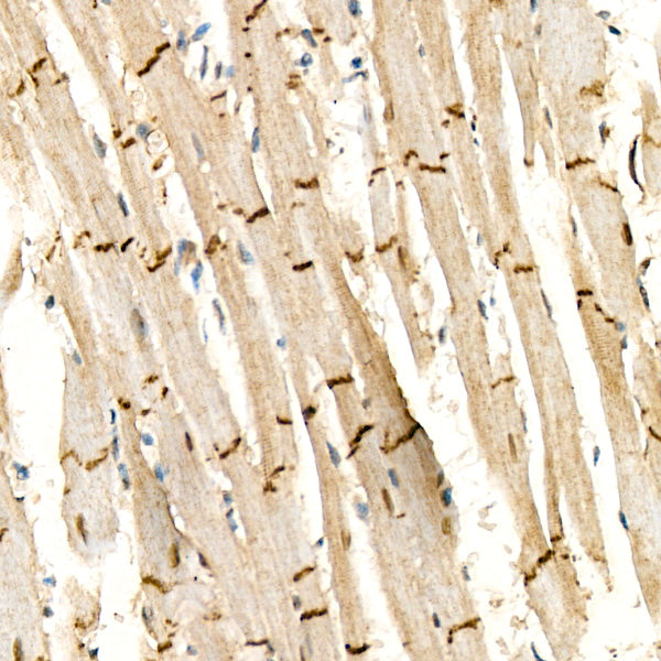Desmoplakin Rabbit pAb