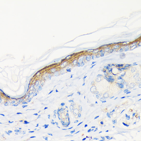 Involucrin Rabbit mAb