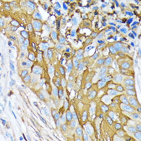Involucrin Rabbit mAb