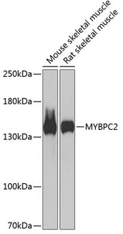 MYBPC2 Rabbit pAb