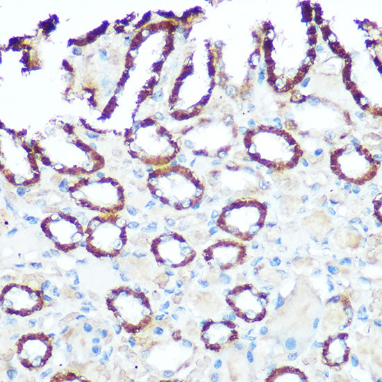 NDUFV1 Rabbit pAb