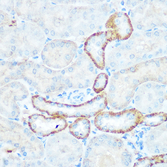 NDUFV1 Rabbit pAb