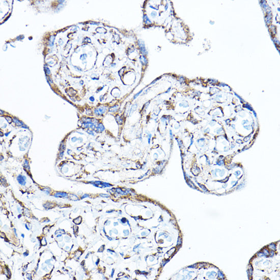 PDK4 Rabbit pAb