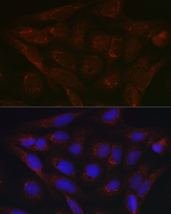 PDK4 Rabbit pAb