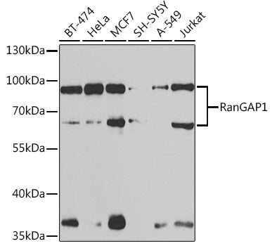 RanGAP1 Rabbit pAb