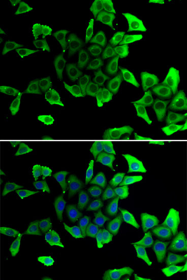 Delta-sarcoglycan (SGCD) Rabbit pAb