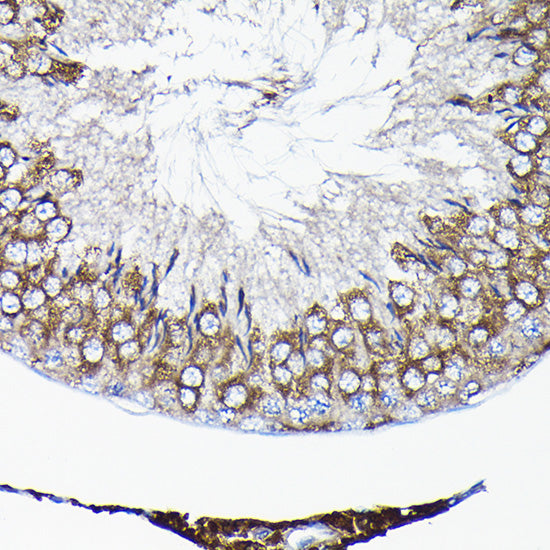 TCP1 Rabbit pAb