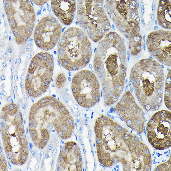 TCP1 Rabbit pAb