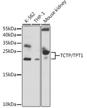 TCTP/TPT1 Rabbit pAb