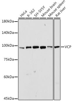 VCP Rabbit pAb