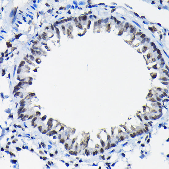 SSNA1 Rabbit pAb