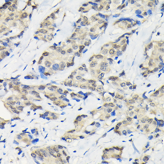 SSNA1 Rabbit pAb
