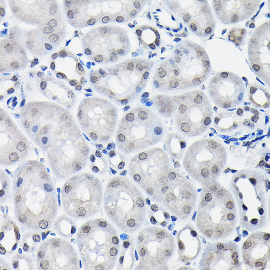 SSNA1 Rabbit pAb