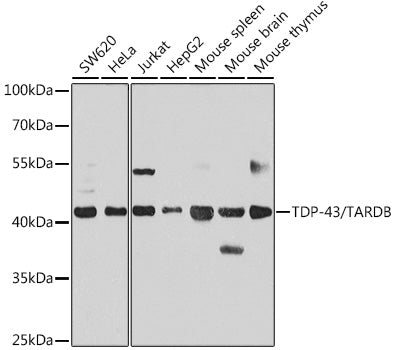 TDP-43/TARDBP Rabbit pAb