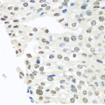 TDP-43/TARDBP Rabbit pAb