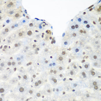 TDP-43/TARDBP Rabbit pAb