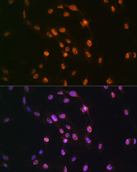TDP-43/TARDBP Rabbit pAb