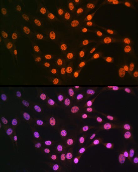 TDP-43/TARDBP Rabbit pAb