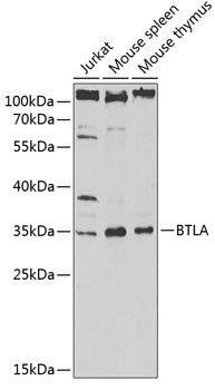 BTLA Rabbit pAb