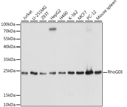 [KO Validated] RhoGDI Rabbit pAb