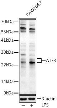 ATF3 Rabbit pAb