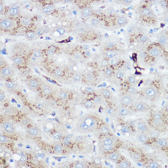 Heme Oxygenase 1 (HO-1/HMOX1) Rabbit pAb