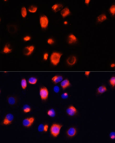 Heme Oxygenase 1 (HO-1/HMOX1) Rabbit pAb