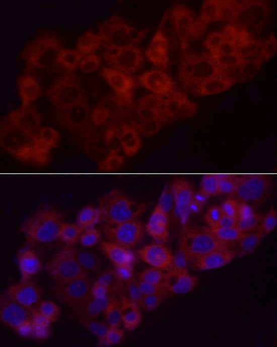 Heme Oxygenase 1 (HO-1/HMOX1) Rabbit pAb
