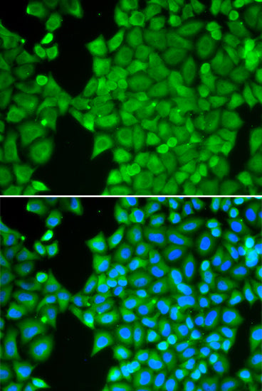 CA3 Rabbit pAb