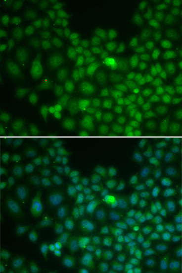 Clusterin Rabbit pAb
