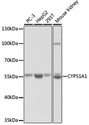 CYP51A1 Rabbit pAb