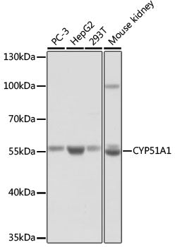 CYP51A1 Rabbit pAb