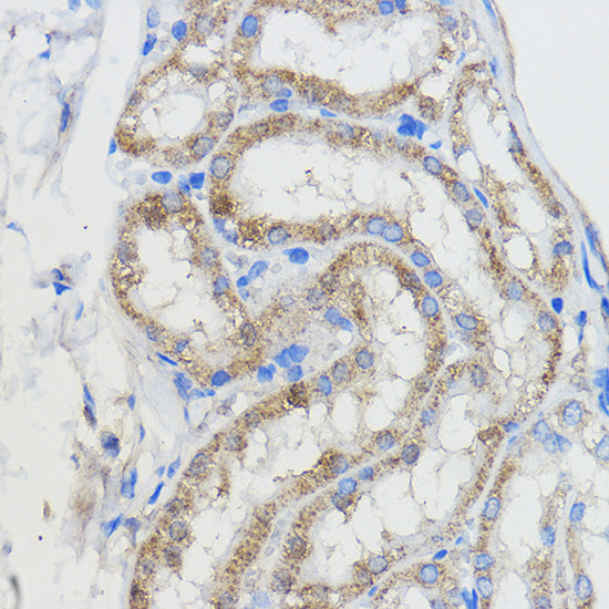 CYP51A1 Rabbit pAb