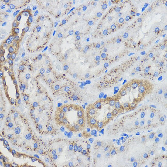 CYP51A1 Rabbit pAb