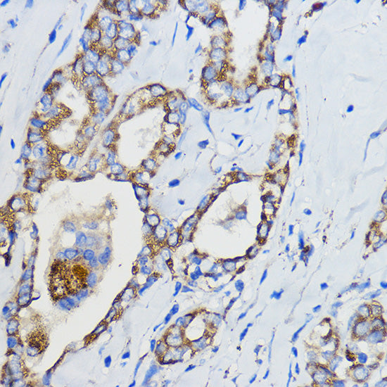 CYP51A1 Rabbit pAb