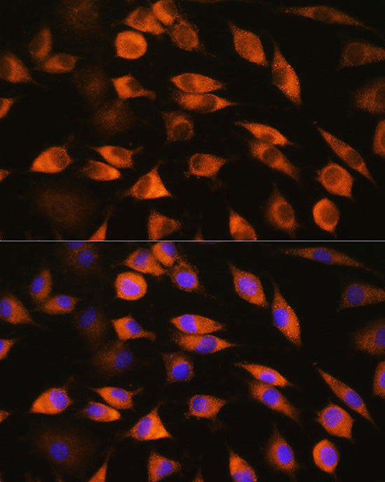 CYP51A1 Rabbit pAb