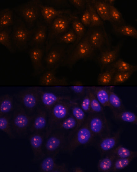 Fibrillarin/U3 RNP Rabbit pAb