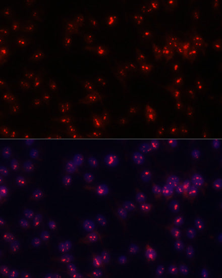 Fibrillarin/U3 RNP Rabbit pAb