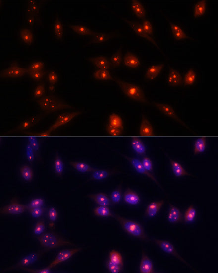 Fibrillarin/U3 RNP Rabbit pAb