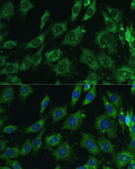 [KO Validated] Galectin 3/LGALS3 Rabbit pAb