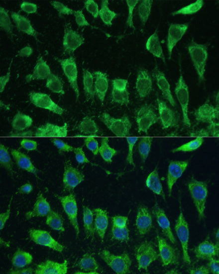 [KO Validated] Galectin 3/LGALS3 Rabbit pAb