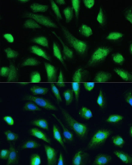 [KO Validated] Galectin 3/LGALS3 Rabbit pAb