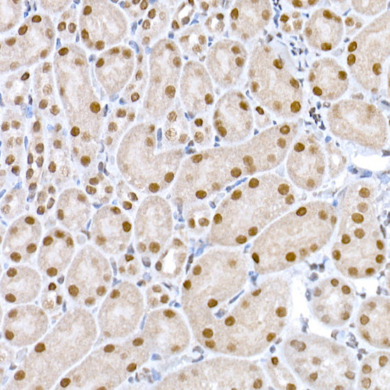 DNA Ligase III/LIG3 Rabbit pAb