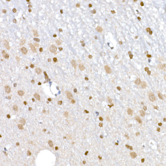 DNA Ligase III/LIG3 Rabbit pAb