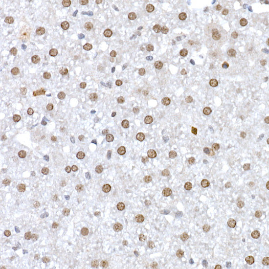 DNA Ligase III/LIG3 Rabbit pAb