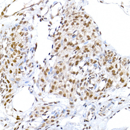 DNA Ligase III/LIG3 Rabbit pAb