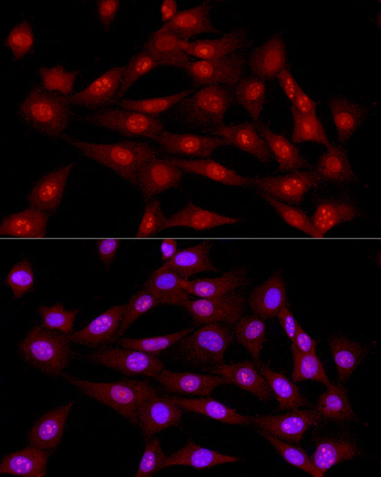 DNA Ligase III/LIG3 Rabbit pAb