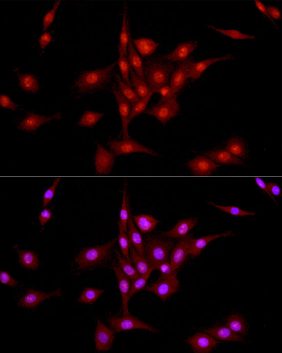 DNA Ligase III/LIG3 Rabbit pAb