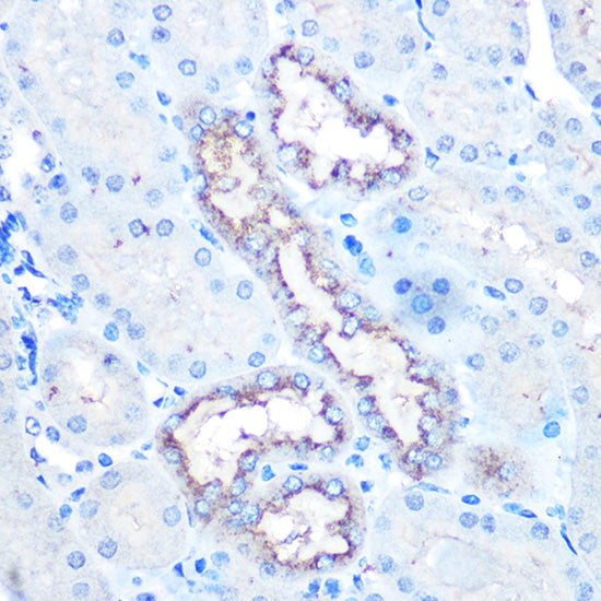 Lysozyme (LYZ) Rabbit pAb