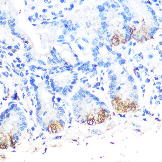 Lysozyme (LYZ) Rabbit pAb